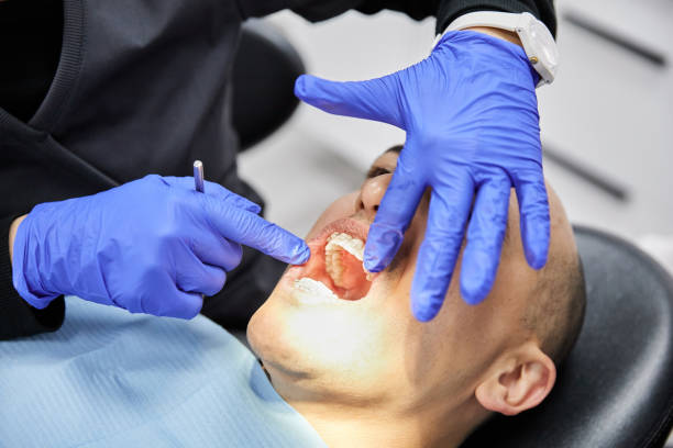 Best Emergency Wisdom Teeth Removal in Chico, WA